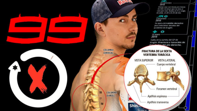 El calvario que ha llevado a Jorge Lorenzo a retirarse - Marca Claro Colombia