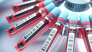Coronavirus hoy: Coronavirus Colombia, noticias del 24 de abril: 4.881 casos casos positivos y 225 muertos a causa del COVID-19 20