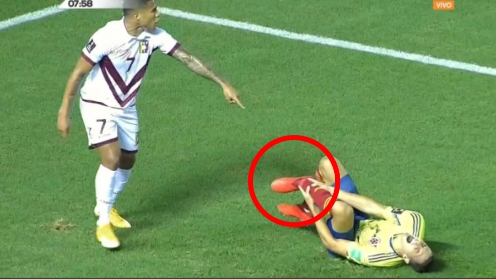 Download Colombia Vs Venezuela Lesion De Arias 2020 PNG